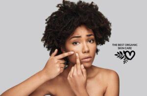 DIY acne spot treatment recipes